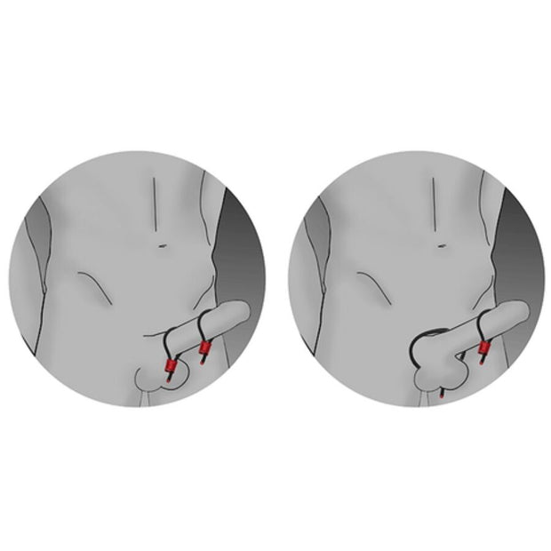 ELECTRASTIM - PRESTIGE ELECTRA LOOPS ANNEAUX PÉNIENS RÉGLABLES ROUGES